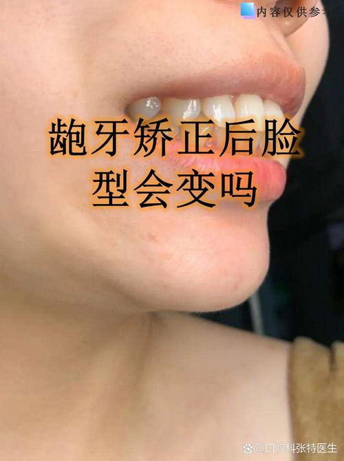 近50岁还能做牙齿矫正吗？-图2