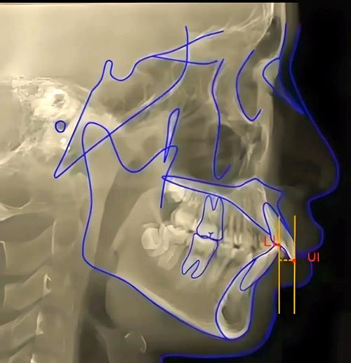 正畸头影测量图下载资源哪里找？-图2