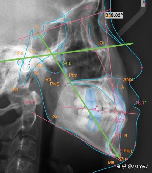 正畸头影测量图下载资源哪里找？-图1