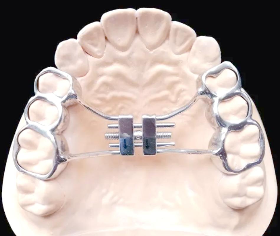 牙正畸结扎丝成型器-图2 牙正畸结扎丝成型器-图2