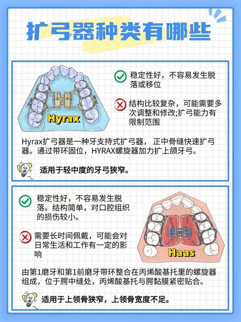 正畸后牙扩弓怎么扩-图1