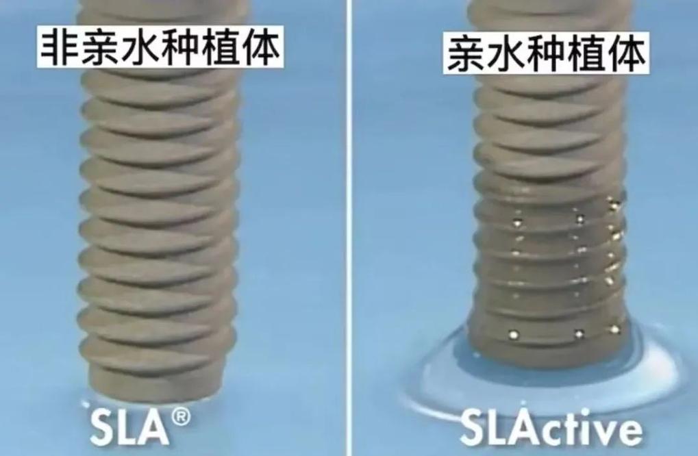 种牙为啥不建议亲水植体-图1