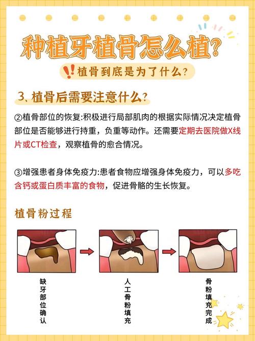 植骨种牙后多久可以恢复-图1