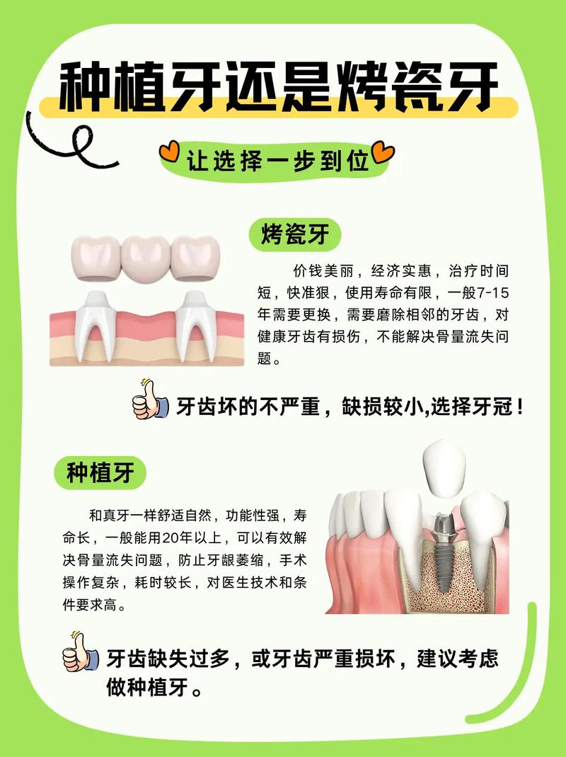 门牙黑,烤瓷牙和种植牙怎么选?-图2 门牙黑,烤瓷牙和种植牙怎么选?-图2