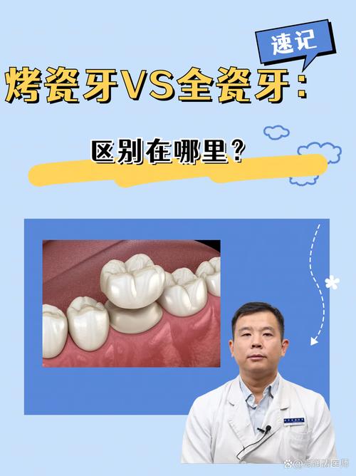 门牙黑,烤瓷牙和种植牙怎么选?-图3 门牙黑,烤瓷牙和种植牙怎么选?-图3