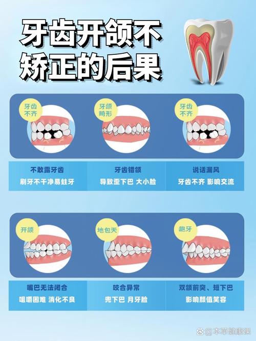 牙齿正畸影响咬合吗-图2