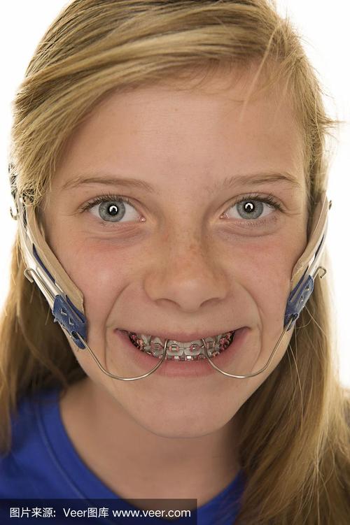 正畸头帽睡觉戴着到底舒服不舒服？-图2