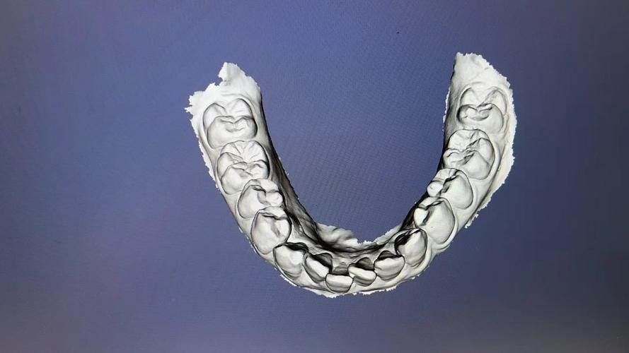 北京德贝植牙被曝黑骗，真相究竟如何？-图3