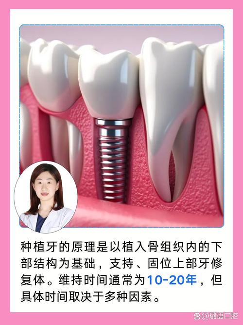 牙植体可以放在牙骨里吗-图3