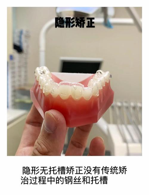 正畸托槽怎么取下？取下过程、方法及注意事项全解析？-图2