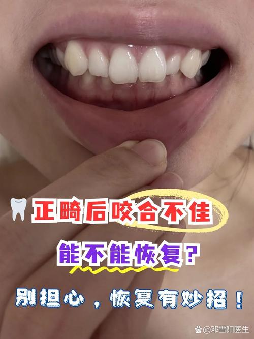 正畸后前牙咬合很紧-图1