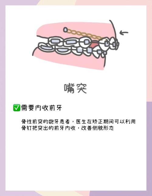 正畸种植钉矫治效果怎样？操作体会、难点及注意事项有哪些？-图2