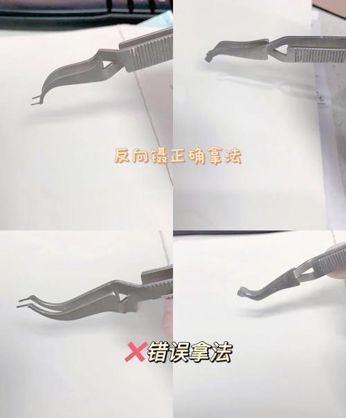 正畸托槽粘贴方法的关键步骤有哪些？-图1