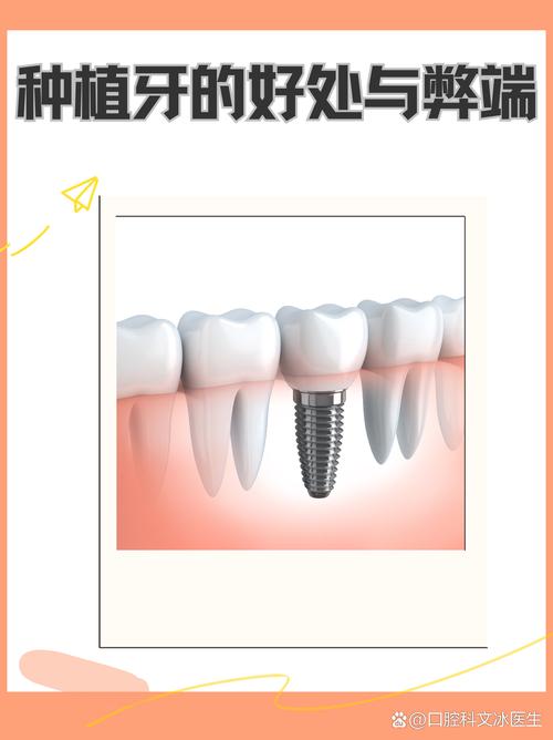 第三代植牙是什么意思-图2