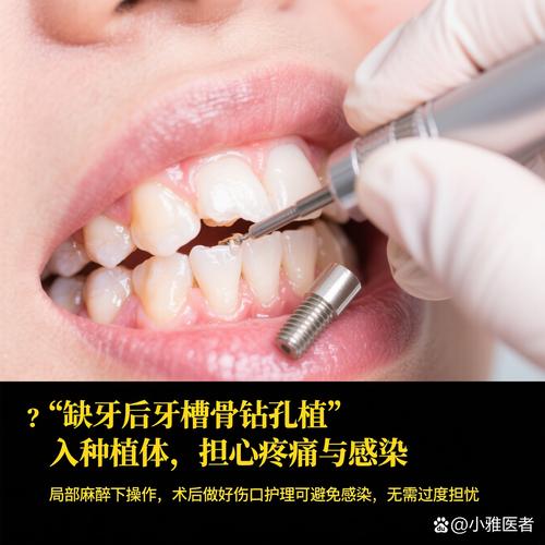 种牙植骨后能玩电脑吗-图1