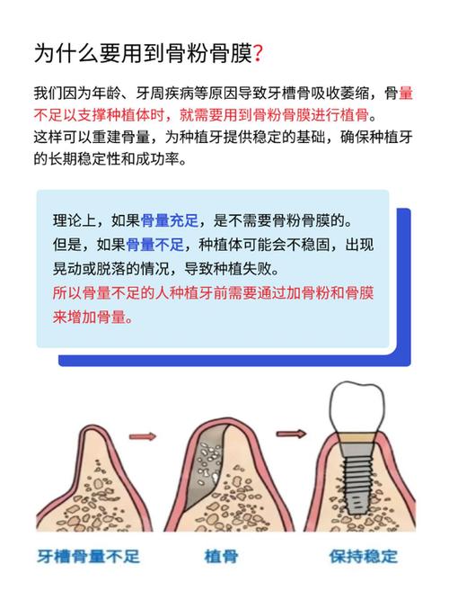 什么情况下种牙才植骨-图2