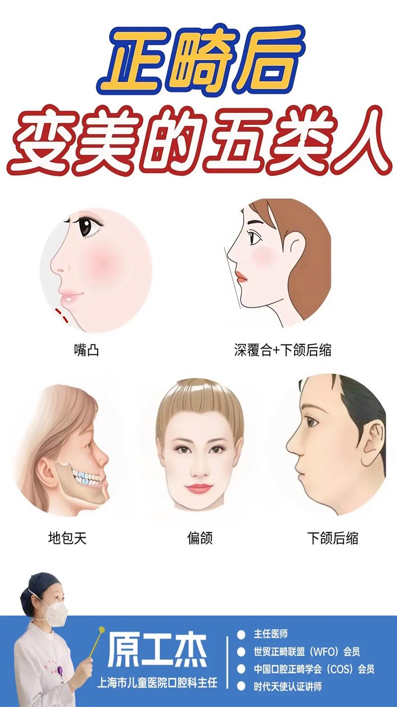 隐形正畸对脸型改变-图3