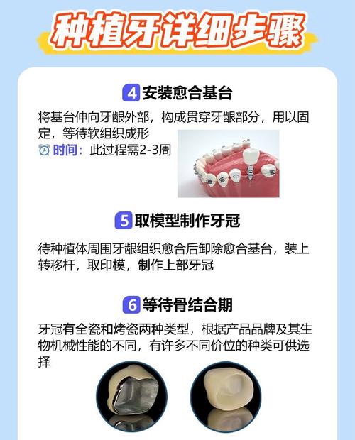 植牙是否人人适用?哪些情况需谨慎?-图1 植牙是否人人适用?哪些情况需谨慎?-图1