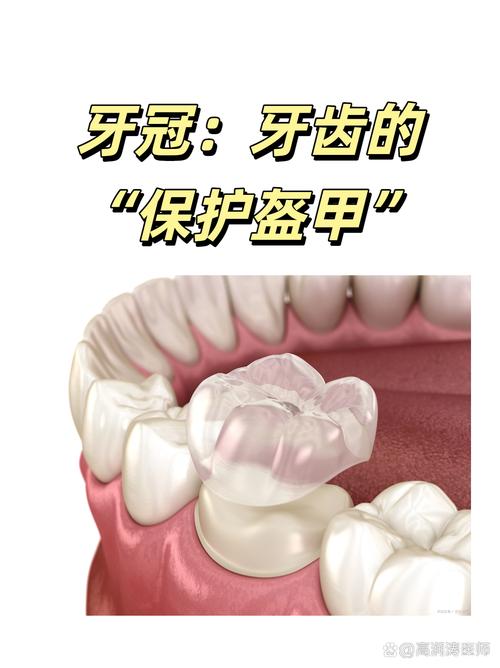 戴牙冠后还能正畸吗？会对牙冠及矫正效果有影响吗？-图3