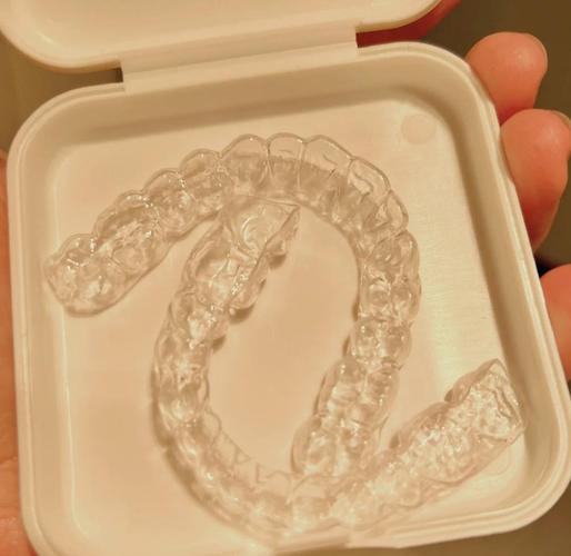 正畸后保持器 更换-图1