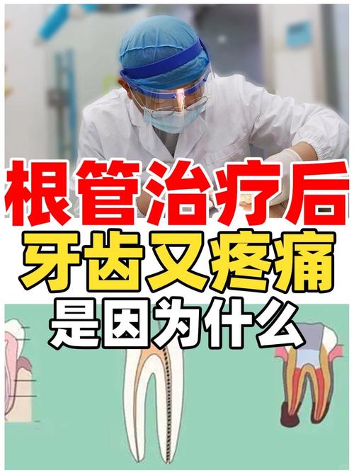 根管治疗VS植牙，到底哪个更疼？-图1