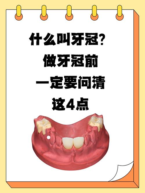 植完牙体后一般需要多久才能戴上牙冠？-图2