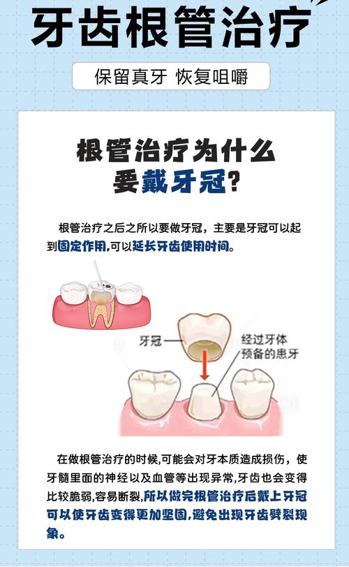 植完牙体后一般需要多久才能戴上牙冠？-图3