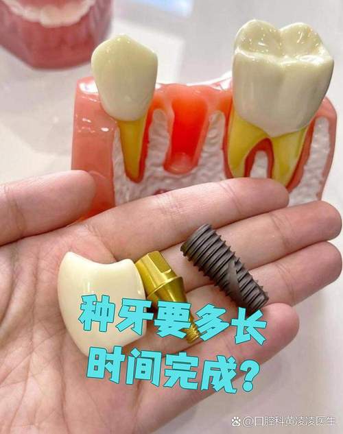 植完牙体后一般需要多久才能戴上牙冠？-图1