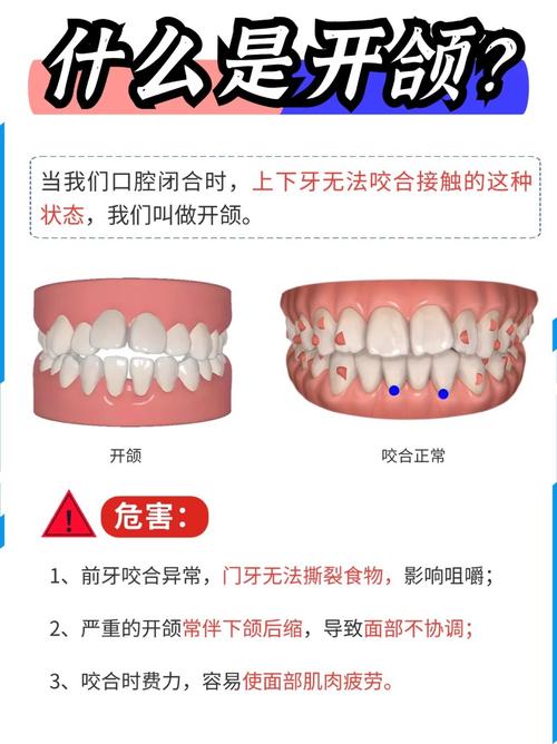 正畸讲义图谱梅老师-图3 正畸讲义图谱梅老师-图3