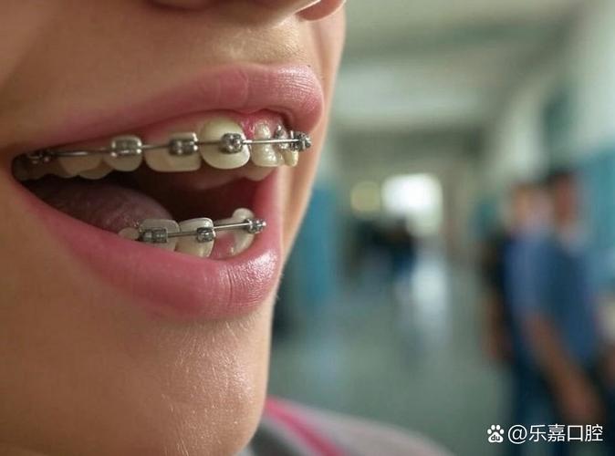 后牙损坏可以正畸吗-图1