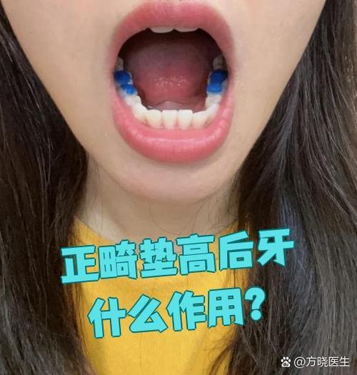 后牙损坏可以正畸吗-图3