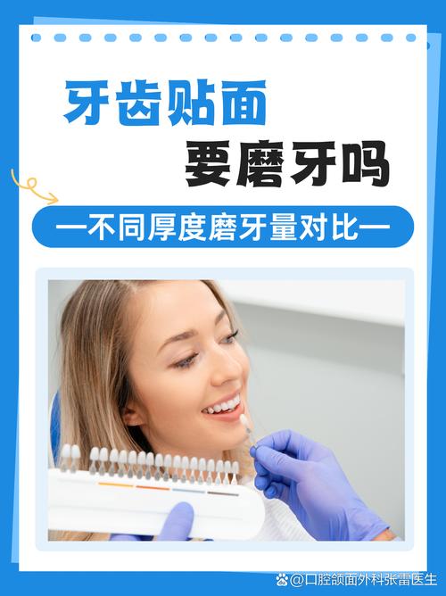 牙齿正畸vs贴面，到底该怎么选？-图1