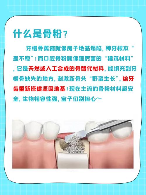 活动的牙可以植骨粉么-图3