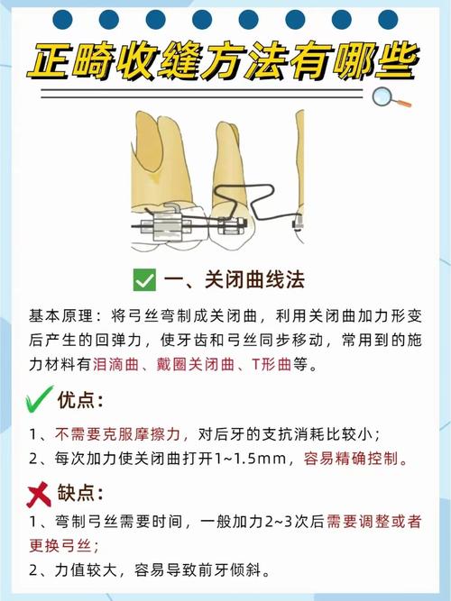 正畸牙怎么关闭缝隙-图1