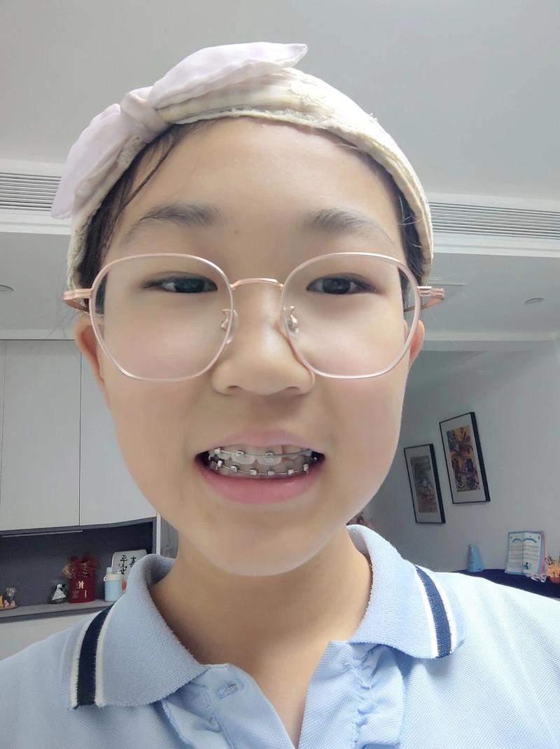 洛阳正畸牙齿矫正哪家好？靠谱机构怎么选？-图2