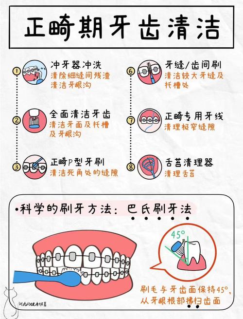 正畸横腭杆怎么刷牙-图1