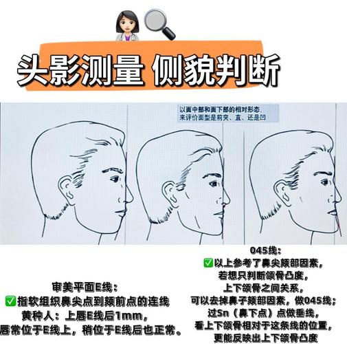 正畸都需要测量哪些关键指标?-图1 正畸都需要测量哪些关键指标?-图1