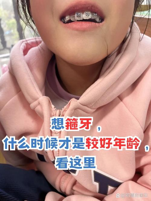 植牙后箍牙，必须拔掉种植牙吗？-图2