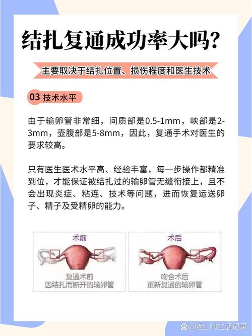 正畸常用的结扎方法有哪些？各自的特点和适用情况是什么？-图2