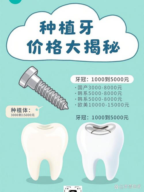 郑州种植牙哪里便宜？这几家报价亲民，靠谱吗？-图2