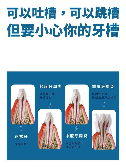 牙槽骨吸收要植骨-图1 牙槽骨吸收要植骨-图1