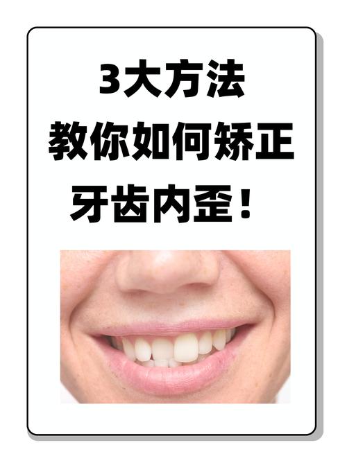 成人牙齿正畸的方法-图2 成人牙齿正畸的方法-图2