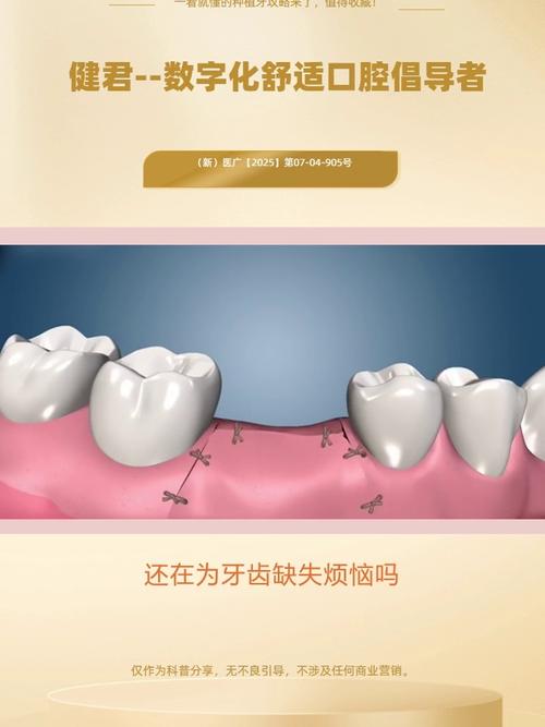 新疆種植牙好不好-图1