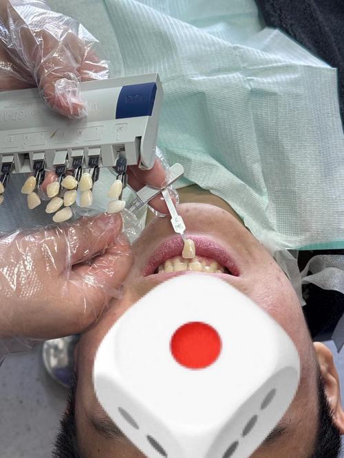 保定市二医院植牙效果如何?价格贵不贵?技术靠谱吗?-图2 保定市二医院植牙效果如何?价格贵不贵?技术靠谱吗?-图2