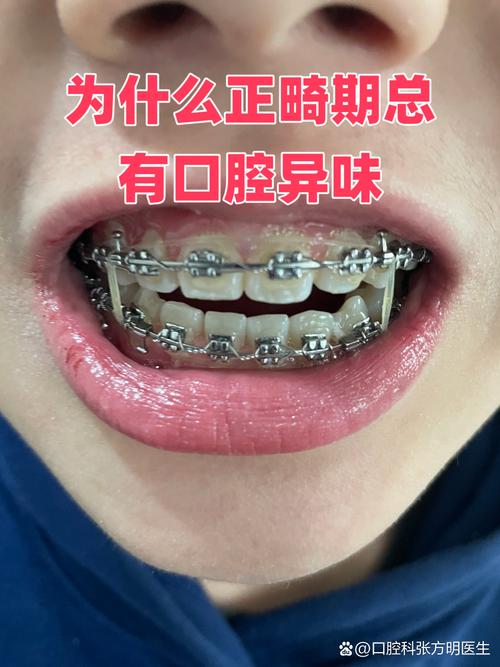 徐国强口腔lh正畸-图3 徐国强口腔lh正畸-图3