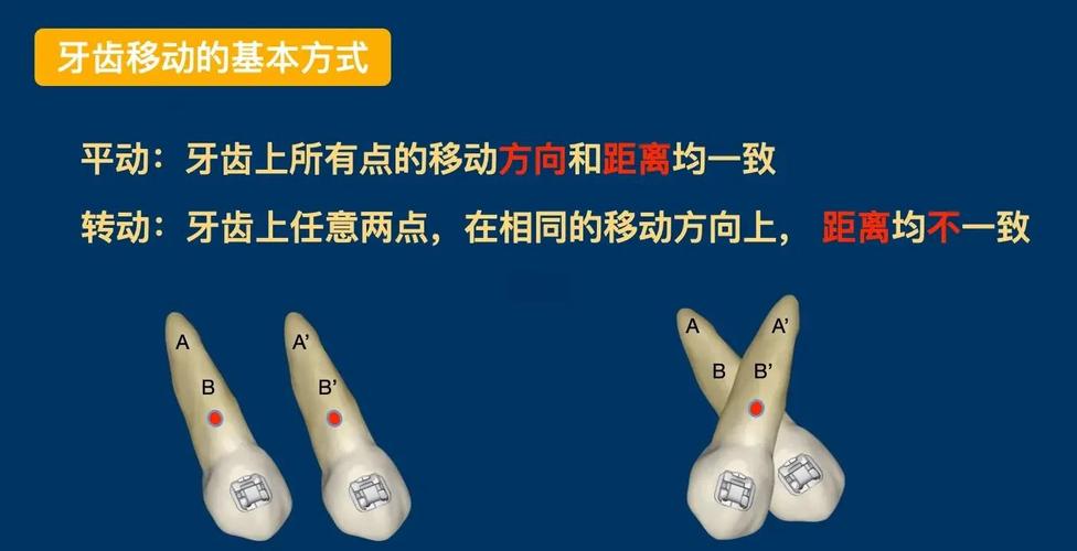 牙齿正畸转矩的概念-图2