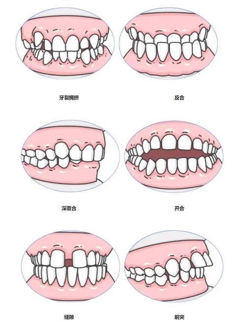 正畸牙齿编号位置图-图1