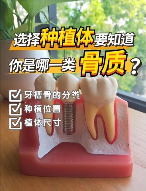 种植牙同期植骨吗-图2