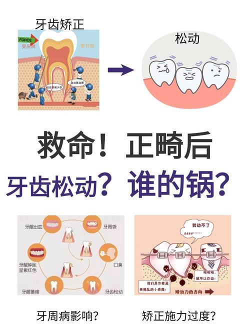 属于正畸治疗引起的-图1 属于正畸治疗引起的-图1
