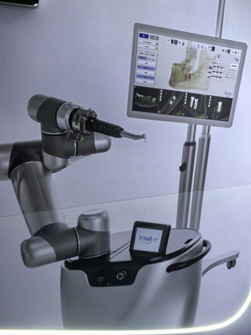 全数字话导航植牙-图1 全数字话导航植牙-图1
